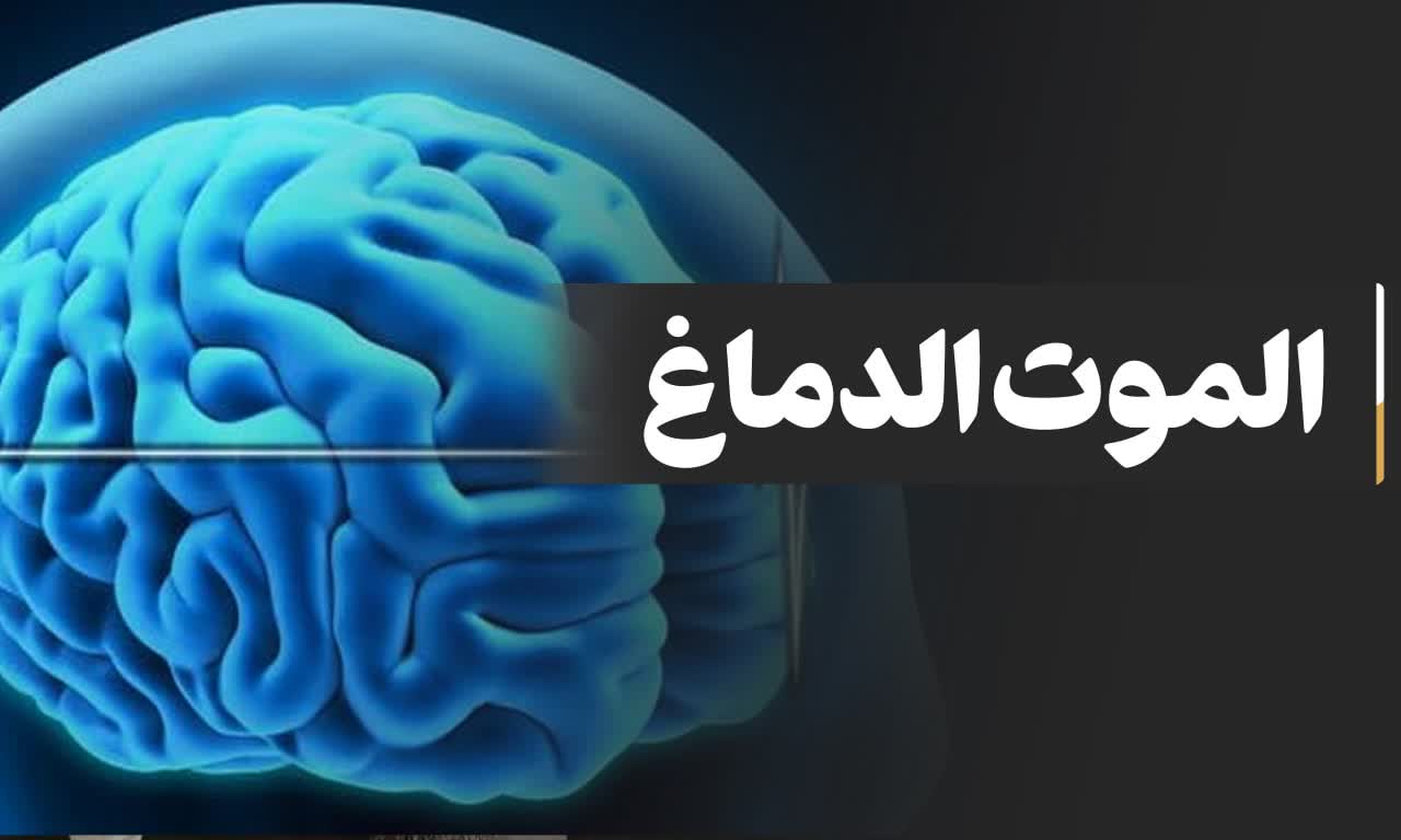 الموت الدماغ
